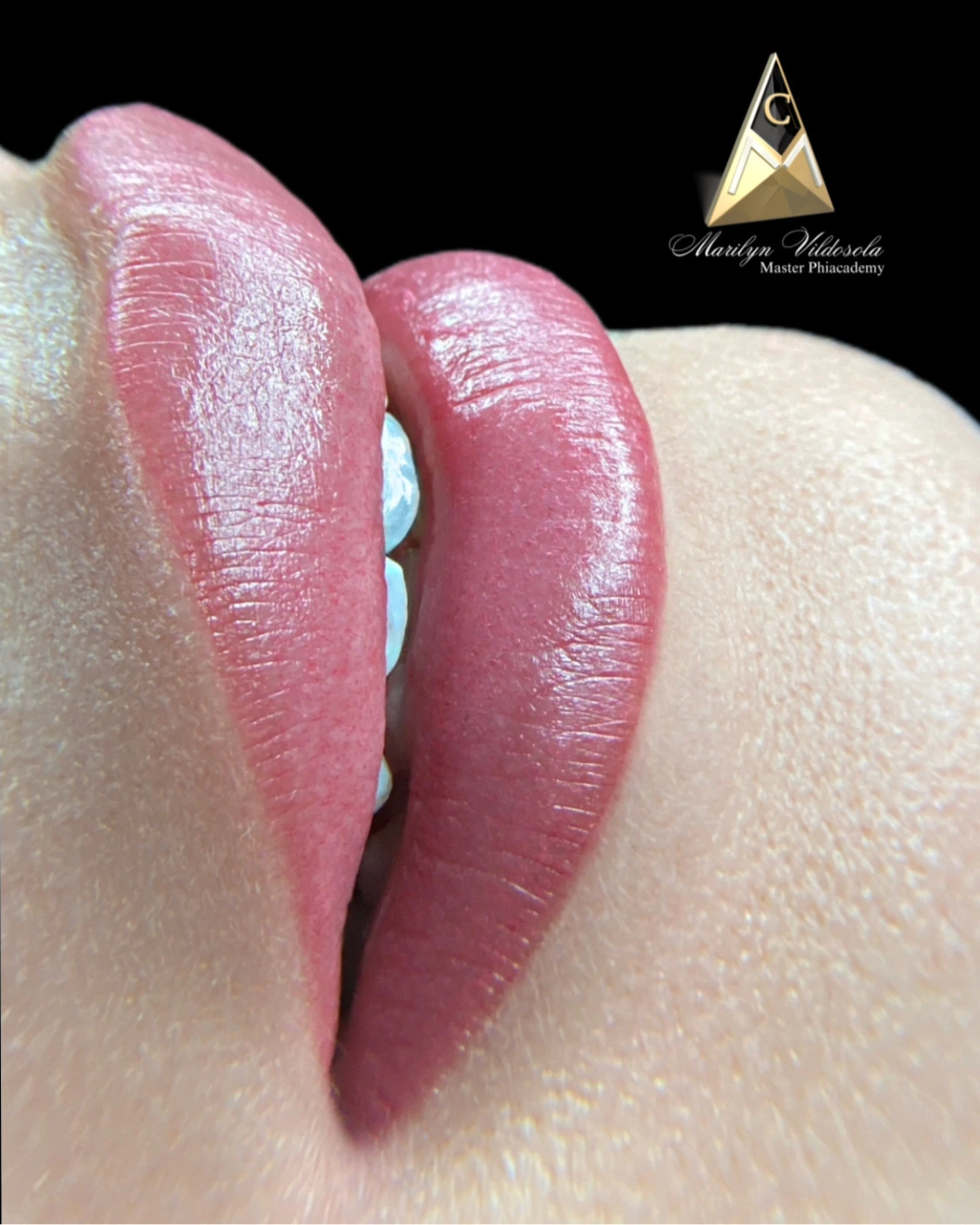 Trabajo de labios de Marilyn Vildosola